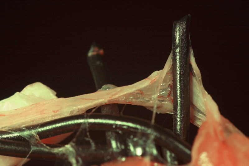 meat and iron (fear)