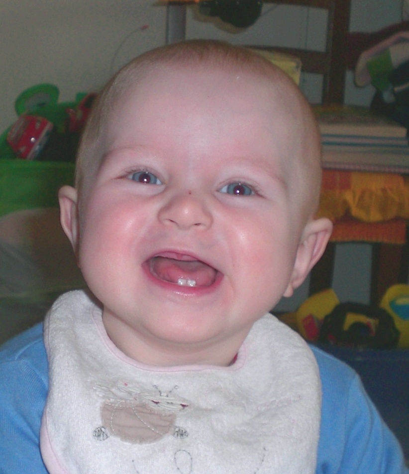 Sorriso a trenta....due denti!