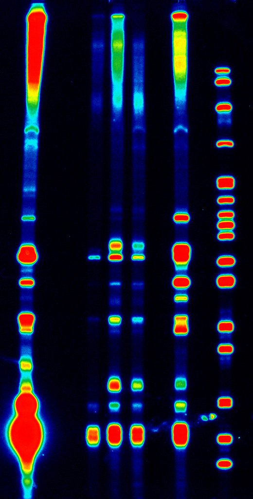 Pseudocolored Radioactive RNA