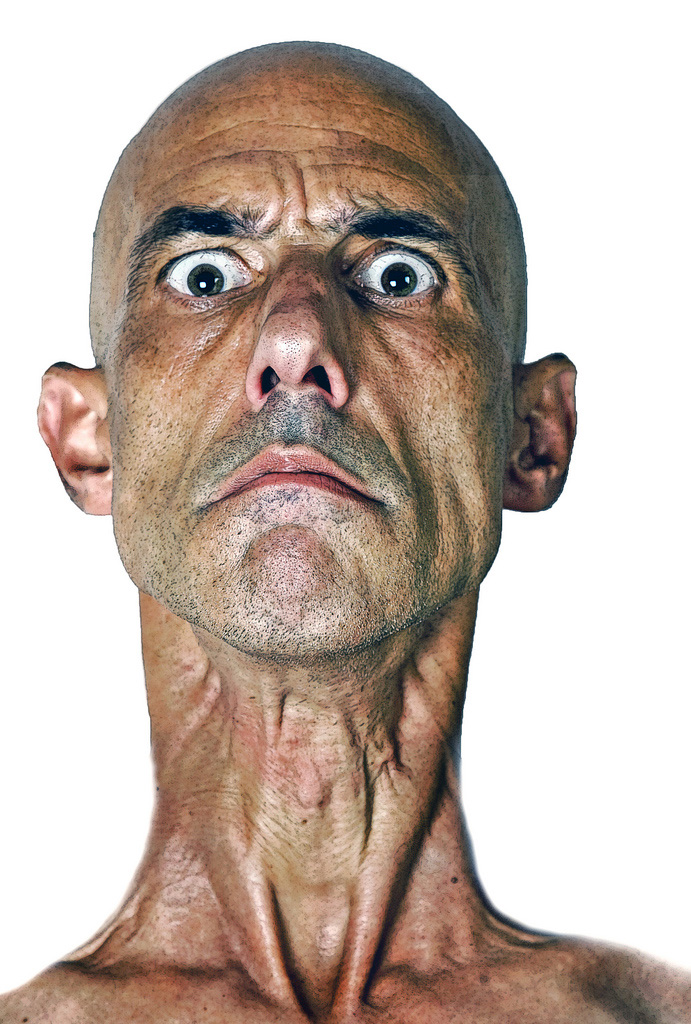 reparto psichiatrico 2