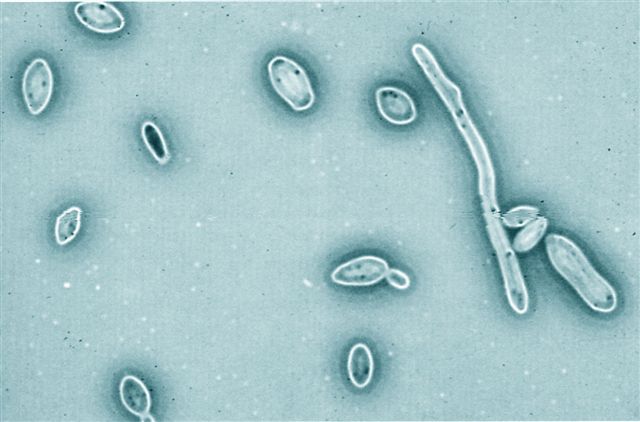 BRETT...L'HO FOTOGRAFATO GRAZIE MICROSCOPIO