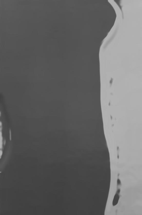 DONNA GRAVIDA 3 MESE