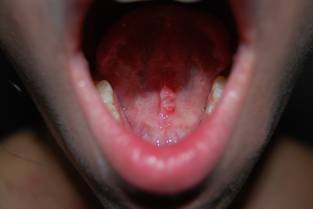 This world isn't kind to little things.