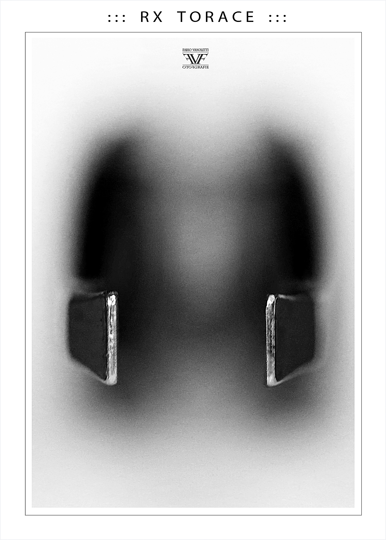 ::: R X T O R A C E :::