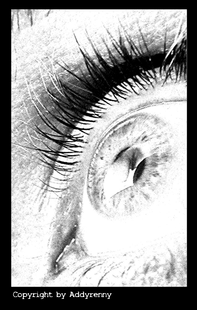 Occhio con ......vizio.