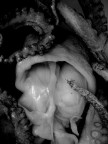 Octopus_part IV