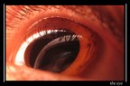 The eye
