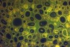 Scatto al microscopio in luce a fluorescenza. Il soggetto � una roccia chiamata "oolite", tagliata molto sottile.
Non vi do i dati di scatto, diciamo comunque che i pallini sono ca. mezzo millimetro.
La posto soprattutto perch� mi � stato fatto notare che sembra una trama di Klimt. Non ci avevo fatto caso ma forse...