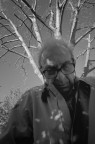 L'uomo albero L'uomo albero