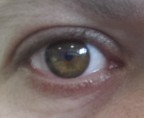 eye eye